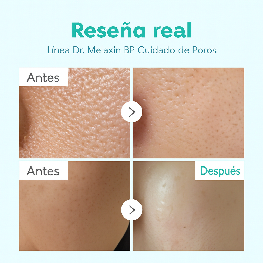 ¡Nuevo Exfoliante Peel-Shot: despídete de los puntos negros en 8 semanas!