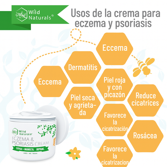 Nuevo crema natural para la piel: elimina la psoriasis y dermatitis desde la primera semana (Copia)