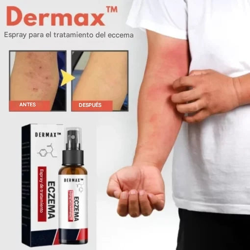 Nuevo spray natural para la piel: elimina la psoriasis y dermatitis desde la primera semana
